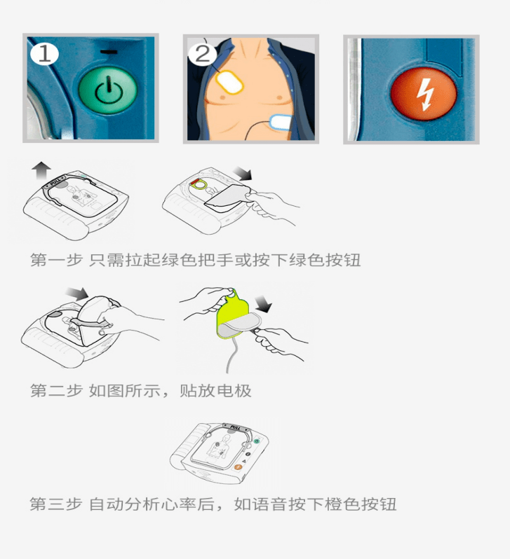 AED自动除颤仪的使用办法